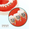 Protector Soportes dentales, 200 unidades/10 paquetes de Brackets de acero