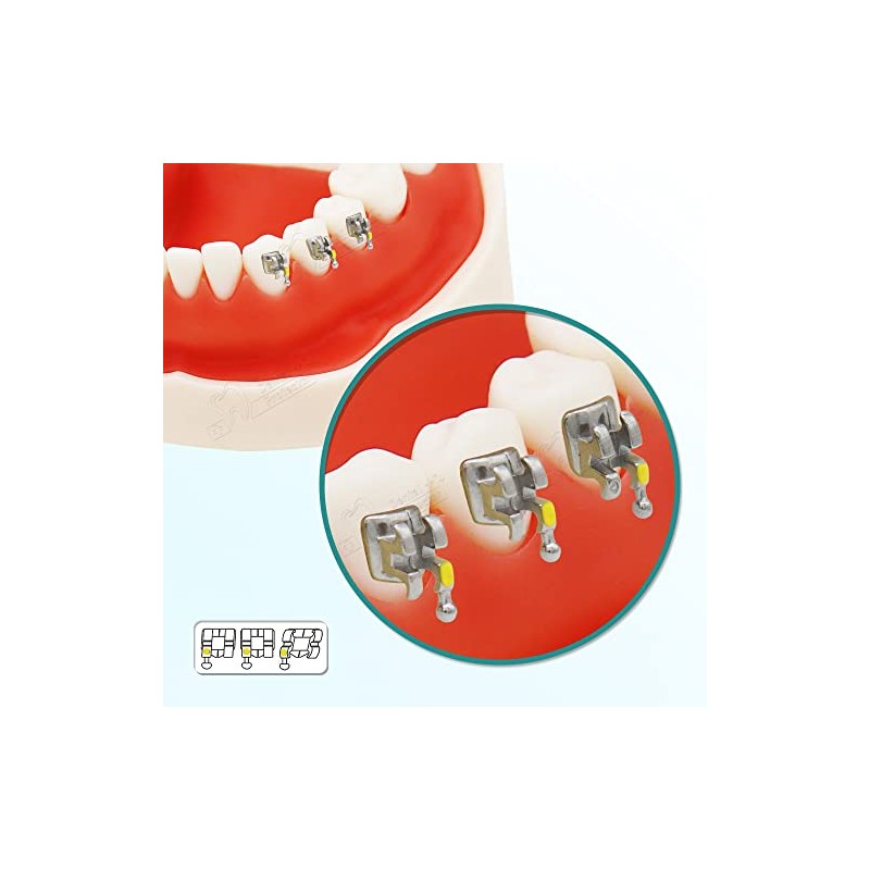 Protector Soportes dentales, 200 unidades/10 paquetes de Brackets de acero