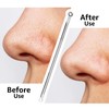 Vega Blackhead Remover - Rounded 1 Pcs