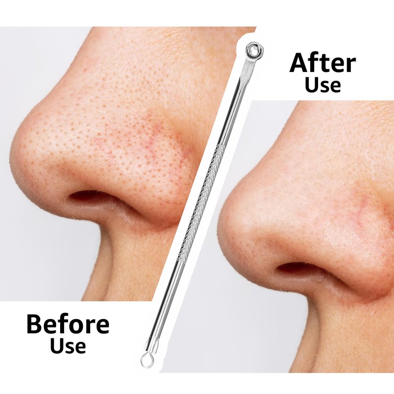 Vega Blackhead Remover - Rounded 1 Pcs