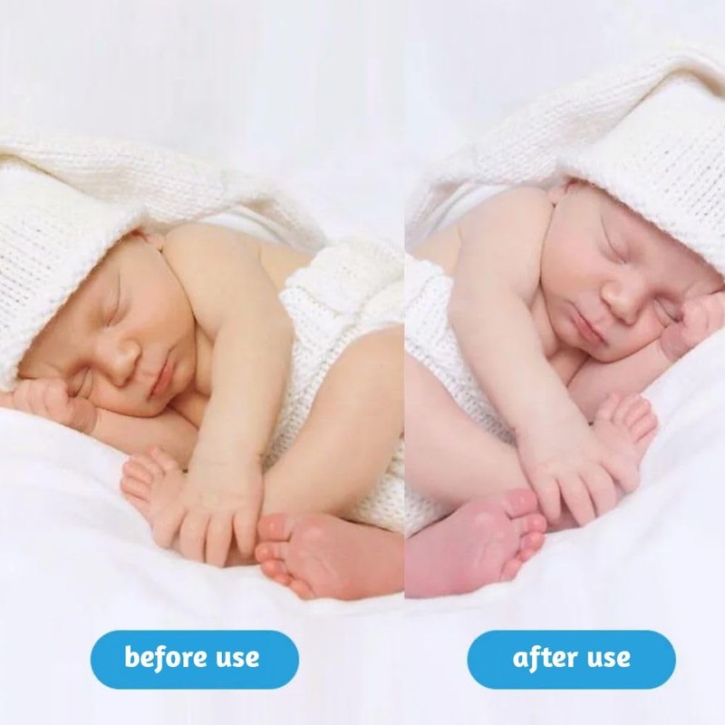 Jaundice Light Therapy Newborn Bilirubin Lamp Blanket Baby Neonatal Jaundice