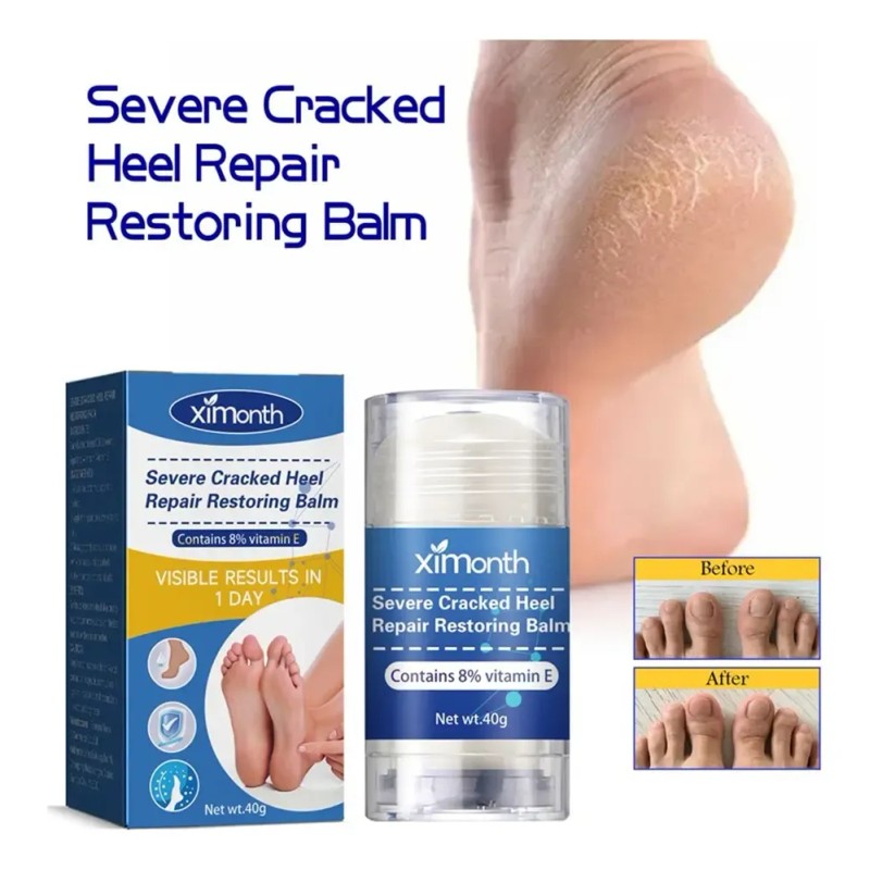 Be - 2×crema Reparadora Grietas Secas Y Talones For Pies