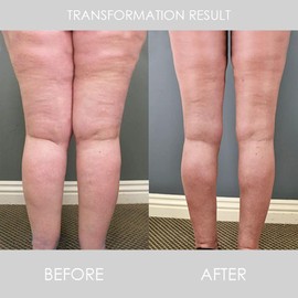 Pulsera Magnética de Drenaje Linfático que Promueve la Relajación Corporal, Aspecto Elegante, Diseño Abierto, Pulsera de Cobre para Mujer, Hogar (B color rojo cobre)