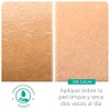 Derman DB Calm Emulsión Corporal │ Urea-D 10% + Ácido