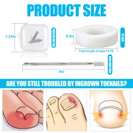 Ferizzia 3 Piece Ingrown Toenails Set, Nail Clip, Toenail Correction, Stainless Steel Manicure Pedicure Set, for Ingrown Nails and Nail Beditis