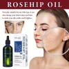 Suero Facial De Aceite De Rosa Mosqueta Con Vitamina C