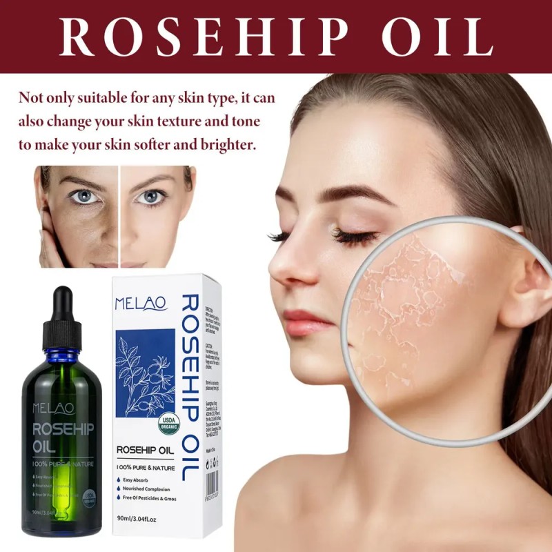 Suero Facial De Aceite De Rosa Mosqueta Con Vitamina C