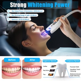 Dental Mobile Teeth Whitener，Portable Whitening Machine Lamp，Practical Bleaching Cold LED Light Accelerator， Bleaching Oral Care Teeth Whitening Maker