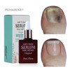 Buzel Viewgel Pedibene Antipung Original 10ml nail art material for