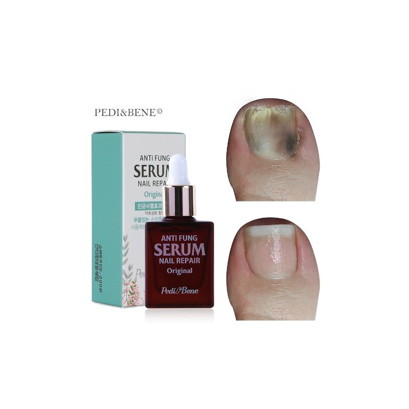 Buzel Viewgel Pedibene Antipung Original 10ml nail art material for