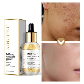 Anillo De Oro R De 24 Quilates Y Poros Espesantes Que Bloque