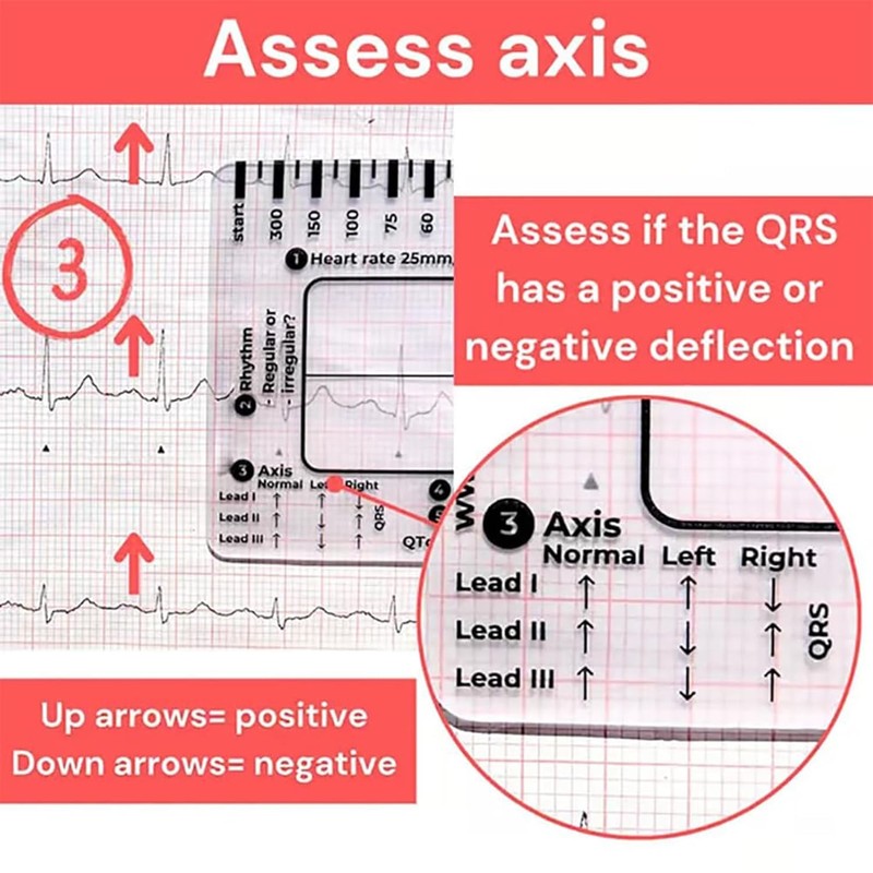 1Pc ECG 7 Step Ruler, ECG 7 Step Ruler for