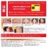 Cyplus Wire Guard, Nail Lifting, Memory Alloy Wire, Hook Nails
