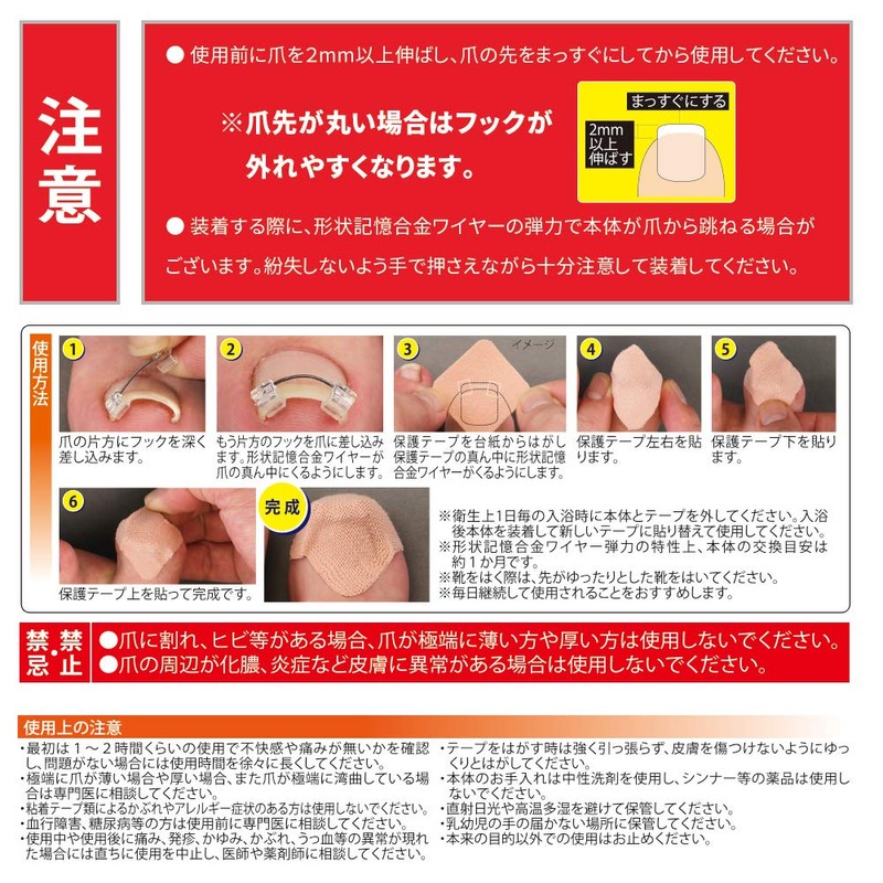 Cyplus Wire Guard, Nail Lifting, Memory Alloy Wire, Hook Nails