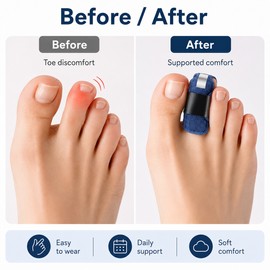 Toe Straightener Splint for Daily Support – Comfortable Hammer Toe Brace for Feet & Fingers