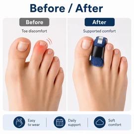 Toe Straightener Splint for Hammer Toe Relief – Comfortable Adjustable Foot Brace Support for Daily Wear