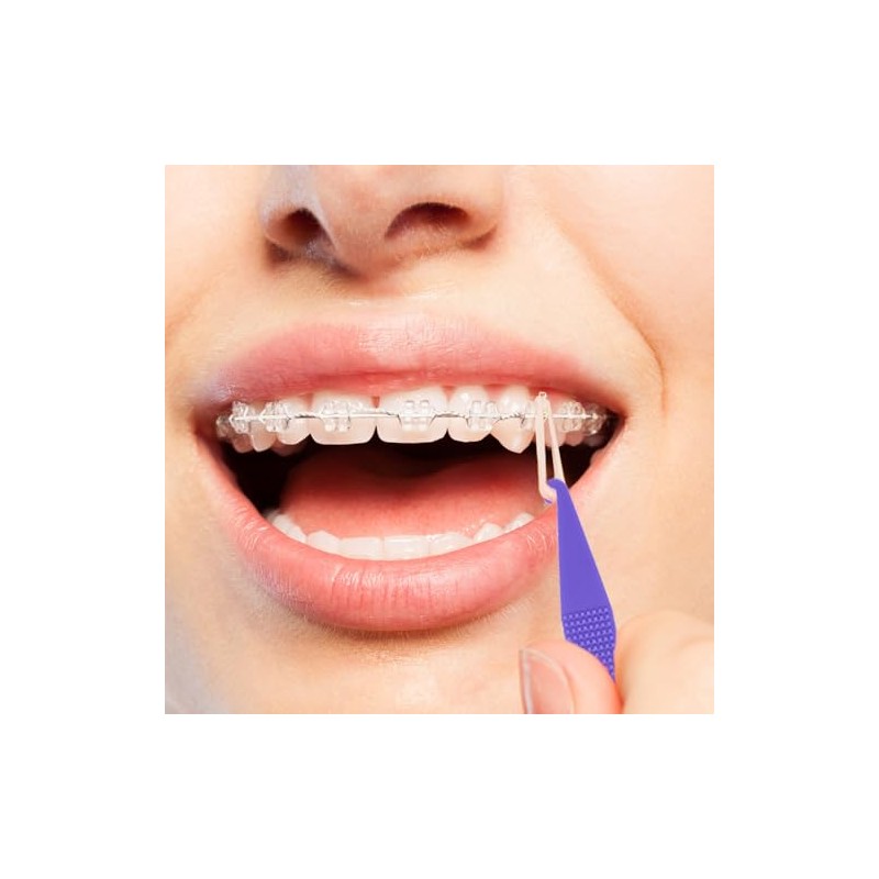 30 bandas elásticas dentales multicolor para tirantes, de plástico, desechables,