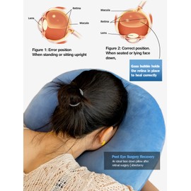 Face Down Pillow After Eye Surgery, Adjustable Height Prone Prone Pillow Face Down Sleep, Retina Lying Pillow, Vitrectomy Macular Hole Retinal Detachment Recovery Equipment Eye Surgery Support