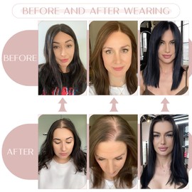 SEGO Pro Hair Toppers for Women Real Human Hair with No Bangs Human Hair Toppers for Women Toppers Hair Pieces for Women Hair Toppers for Thin Hair #1B Natural Black 10 Inch