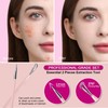 Teenitor Pimple Extractor Acne Treatment Tool Blackhead Comedone Removal 2-in-1