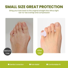 Gel Pinky Toe Separators for Women - Bukihome 10 Pack Toe Spacers for Overlapping Toes, Bunions, Toe Alignment, Bunion Relief - Soft Silicone Toe Corrector for Men (Pinky Size)