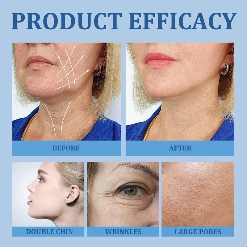 MILIZHIWU Chinology Chin Mask Double Chin, Reusable Chinology Chin Lifting