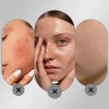 Crema Antipecas Y Crema De Noche Para Mujeres Con Manchas