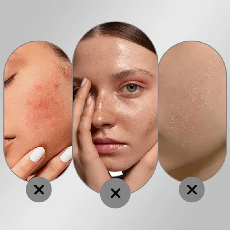Crema Antipecas Y Crema De Noche Para Mujeres Con Manchas