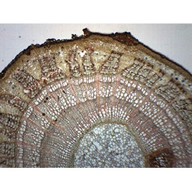 EISCO 10PK Tilia, 3-Year Stem - Prepared Microscope Slides - Classroom Pack, 10 Slides in Storage Case - Biology & Microscopy