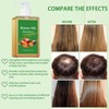 2pcs Batana Oil Shampoo,Organic Batana Oil for Hair Growth,Anti Hairs