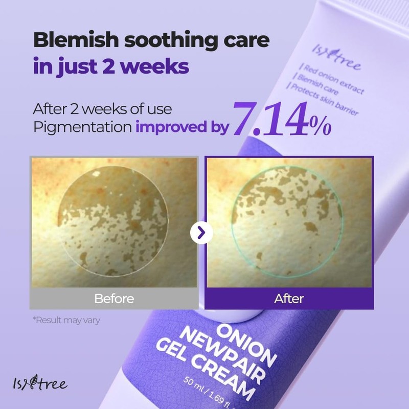 IsNtree Onion Newpair Gel Cream skin soothing,hydration,care acne spots and