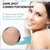 Tkekruh Dark Spot Remover for Face