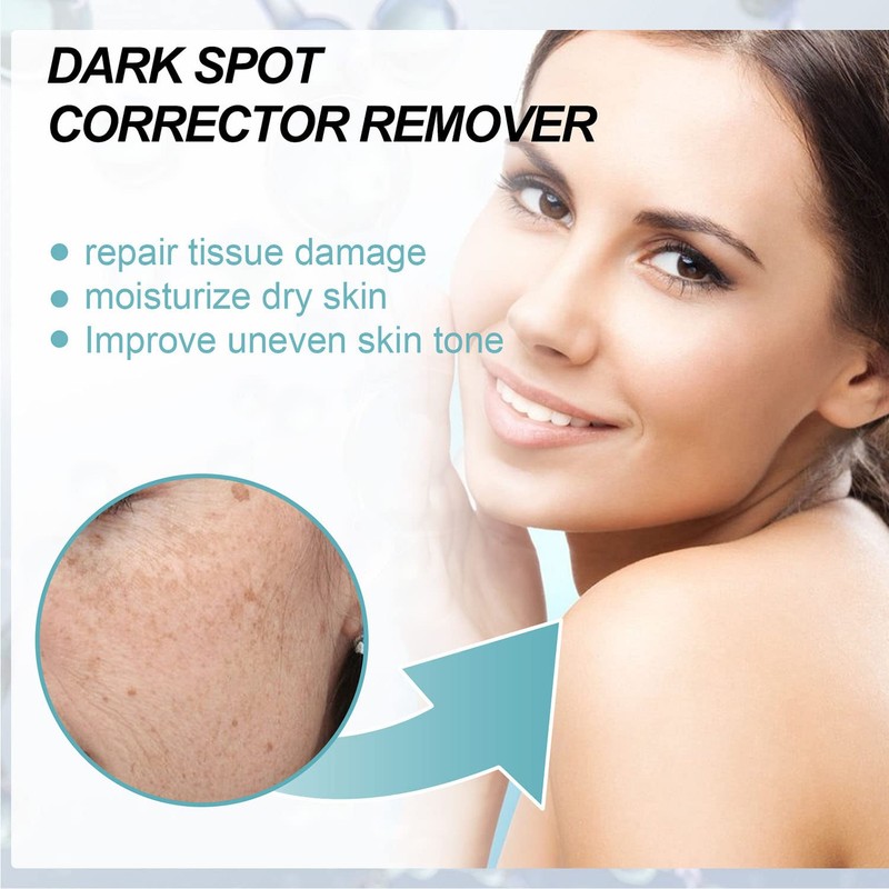 Tkekruh Dark Spot Remover for Face