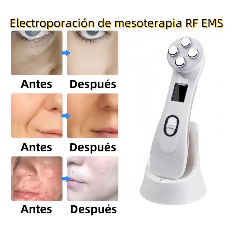 Radiofrecuencia Facial Electroporador Ems Rejuvenece Arrugas Blanco