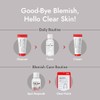 [MIZON] GOOD BYE BLEMISH CLEAR PATCH (x44) Korean Skincare -