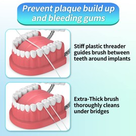 Easy-to-Use Sponge Floss for Cleaning of Implants Bridges with Stiff Plastic Ends and Sponge Floss Oral Hygiene (1)