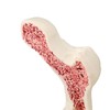 Osteoporosis Spine Model for Teaching and Demonstration, Visualize Bone Density