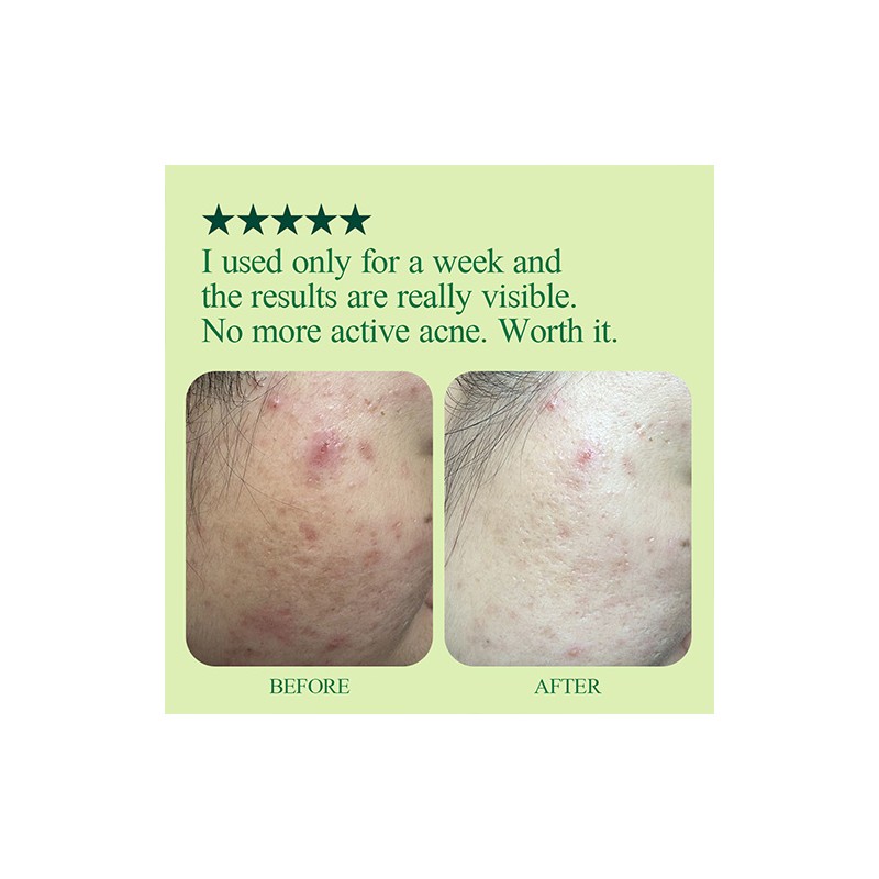 Pyunkang Yul [Pyunkang Yul]Ultimate Calming Solution Cream 30ml