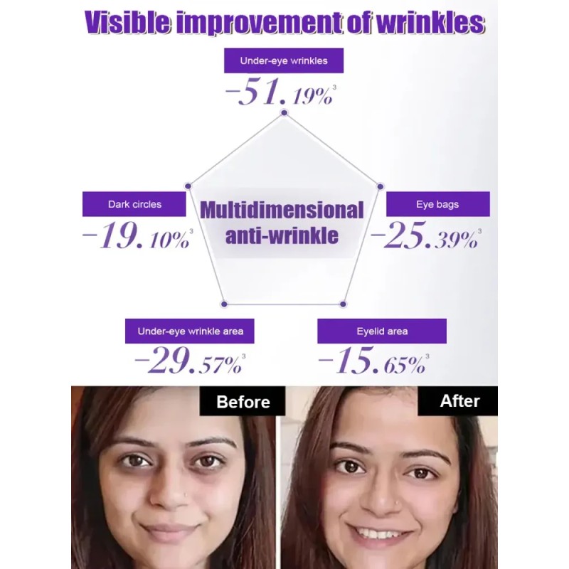 Lifting 3d Compatible With Reduce Arrugas And Calcium Inten