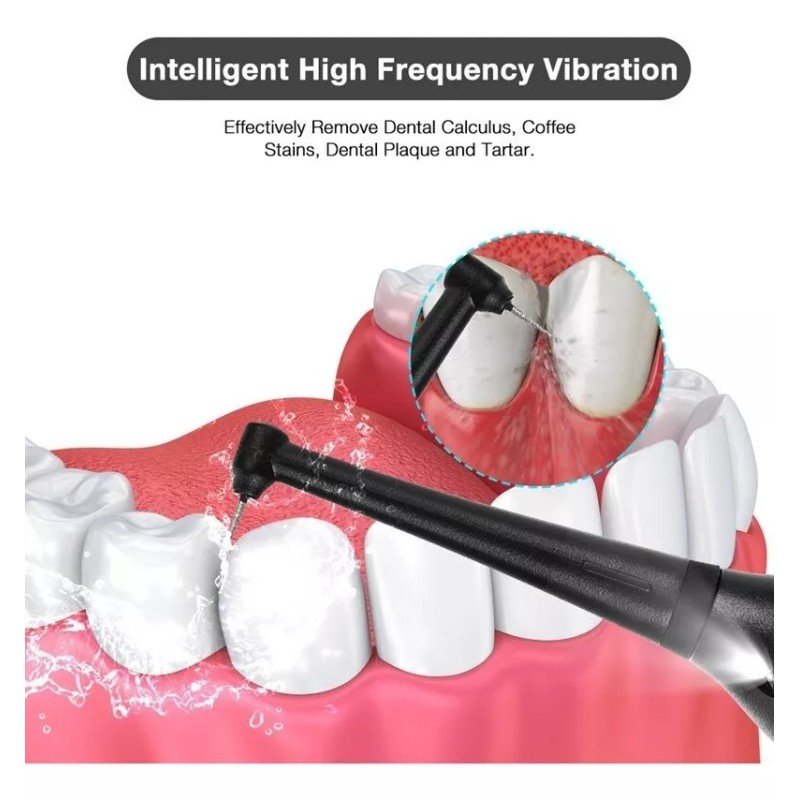 Cuidados De Clareamento E Ferramentas De Remoção De Tártaro