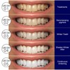 5D Teeth Whitening Strips with 30-Minute Application, Visible Brightening Teeth