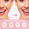 600pcs Pimple Patches Pueden Absorber Secreción Parches Acne Calcomanías Puntos
