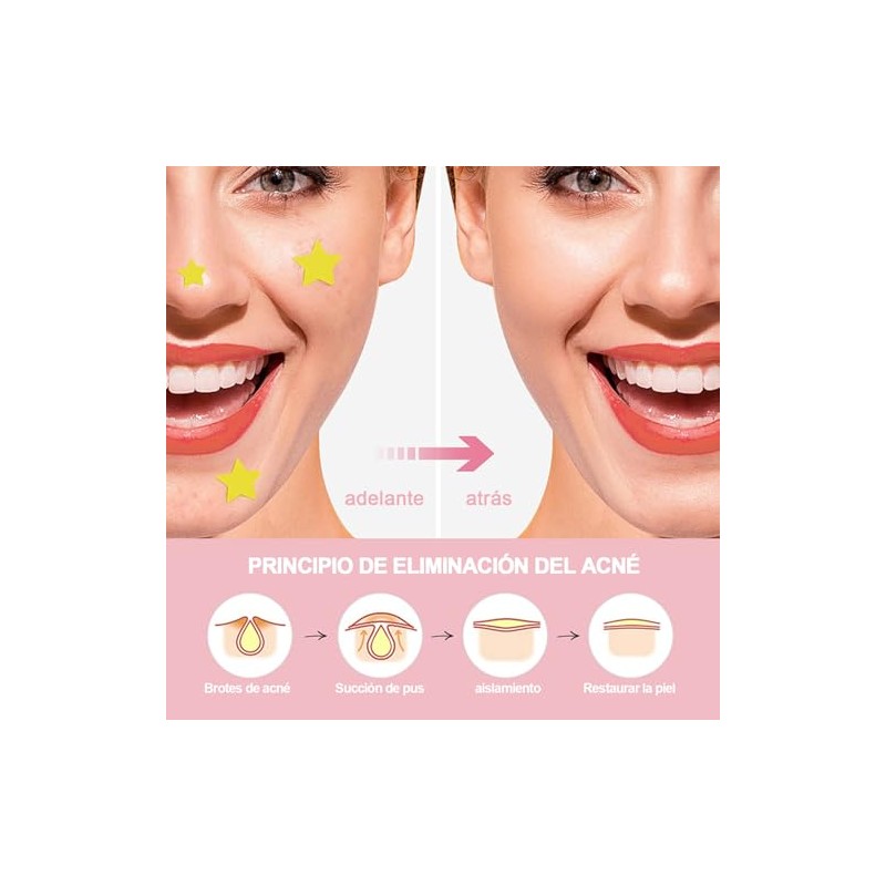 600pcs Pimple Patches Pueden Absorber Secreción Parches Acne Calcomanías Puntos