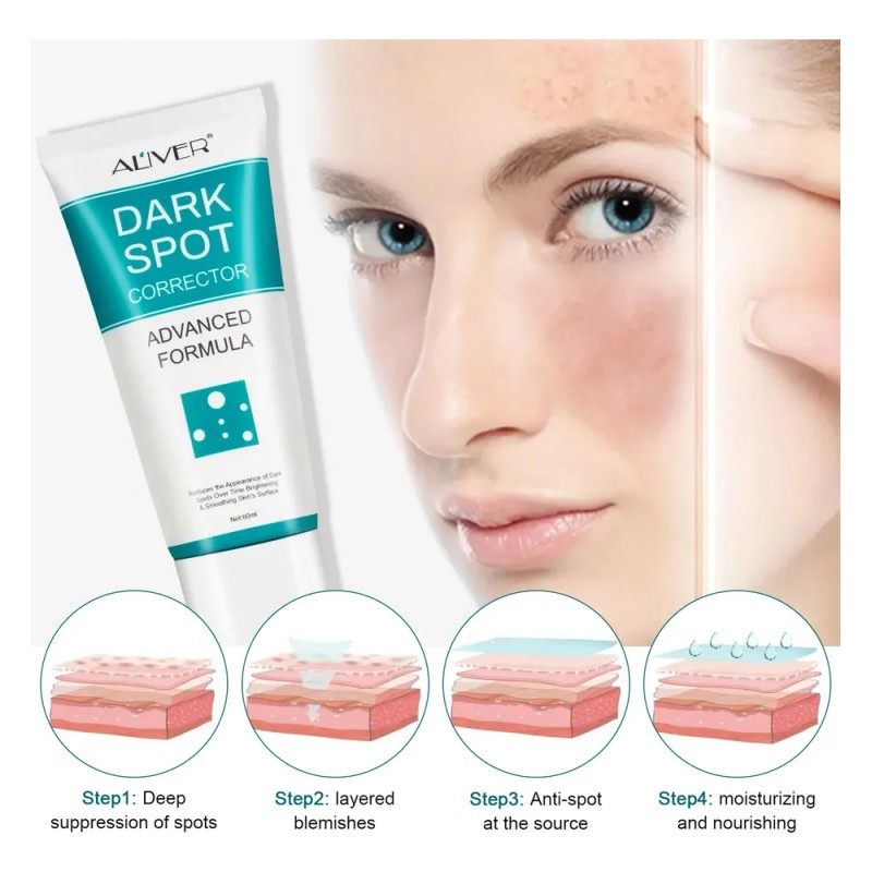 Crema Correctora Facial Manchas Acné Paño Puntos Negros