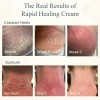 Cream, Growth Factor Skin Repair For Cracked Heels, Hands,