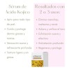 Tratamiento Serum Aclarante Manchas Paño Pecas Acne 30ml