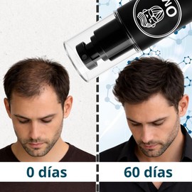 Kit Crecimiento Capilar Anticaída, Shampoo y Hair Tonic, con Biotina, Ginseng, Extracto de Romero, Niacinamida, Capixyl™ . Crecimiento y Fortalecimiento de Cabello, Sin Sulfatos ni Parabenos, Uso Diario. Crecimiento