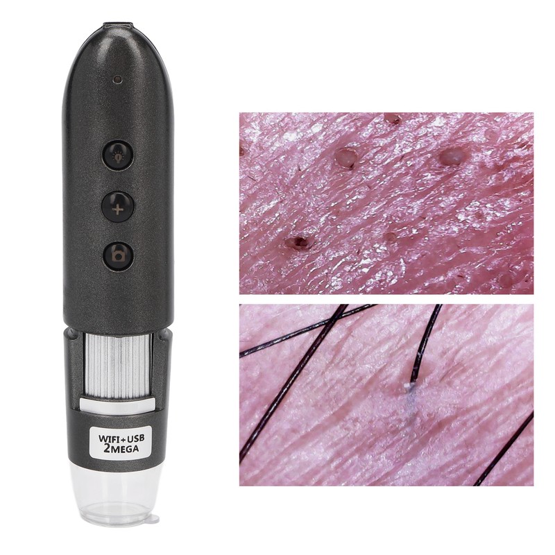 200X Magnification Skin Hair Scalp Detector 2MP Wifi USB High