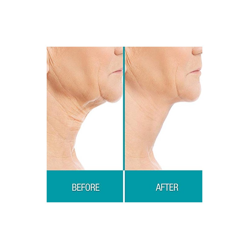 Dermactin Crepe Gone Crema Reafirmante Cuello Color Talla Única