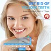 Teeth Whitening Strips (28PCS)